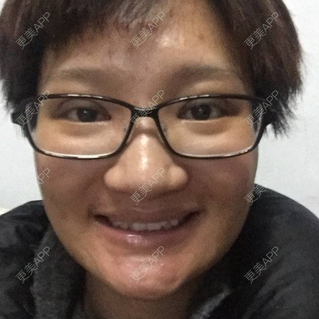 更美 - 更美用户9ItXKx0mgk的经验 | 牙齿治疗