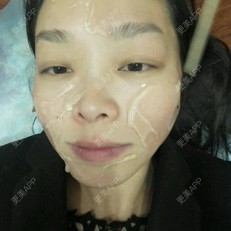 更美 - 哈哈豆豆龙的经验 | 皮肤美容 | 光子嫩肤 | 激光永久脱毛 | 昆明