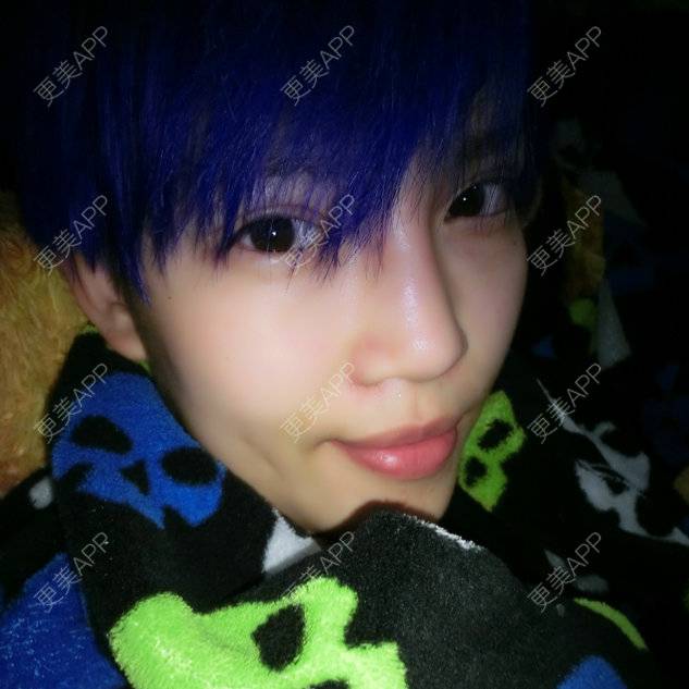 更美 - PERSONALITY-397的经验 | 鼻部整形 | 自体软骨垫鼻尖 | 缩鼻翼 | 无锡