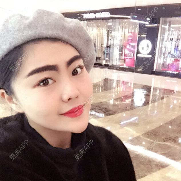 更美 - 刘鉴韦的除皱瘦脸经验 | 硅胶垫下巴 | 除皱瘦脸 | 吸脂瘦脸 | 西宁