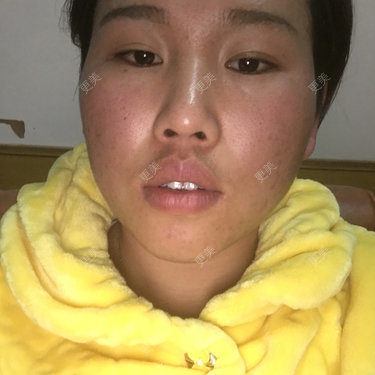 面部轮廓