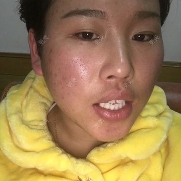 面部轮廓