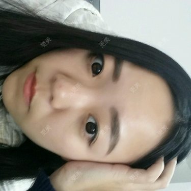 鼻部整形