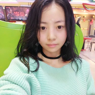 玻尿酸