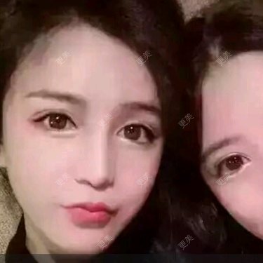 瘦脸除皱