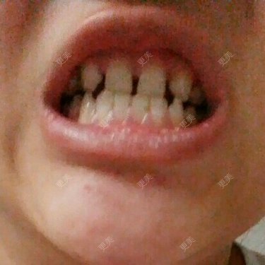 口腔齿科