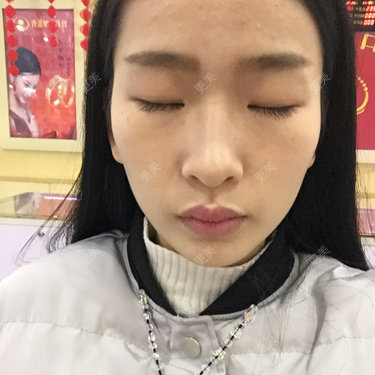 太阳穴