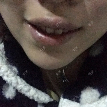 更美用户qSB0r1Jjtp