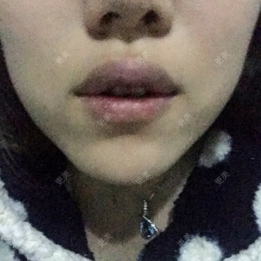 更美用户qSB0r1Jjtp