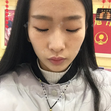 太阳穴