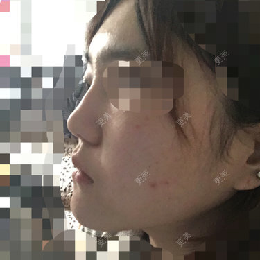 本宝宝要逆袭