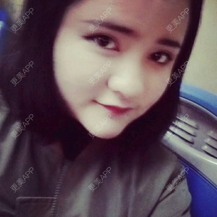 更美 - Vivika欧克的经验 | 近视镜片矫正