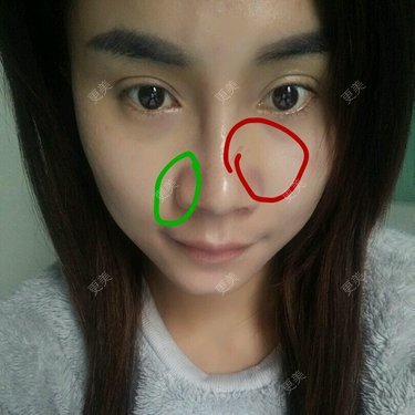 嫣 然。