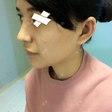 小小Rui