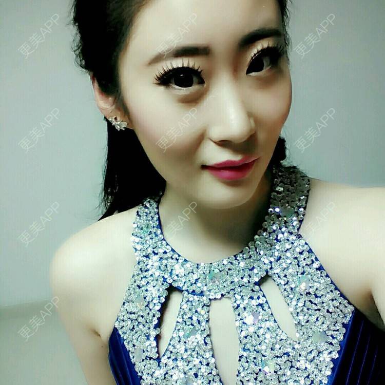 更美 - 壮壮的红蓝光清痘经验 | 威海 | 祛疤痕痘印 | 红蓝光清痘 | 鼻部多项 | 双眼皮