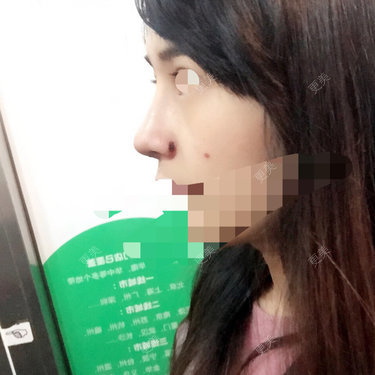 小小Rui