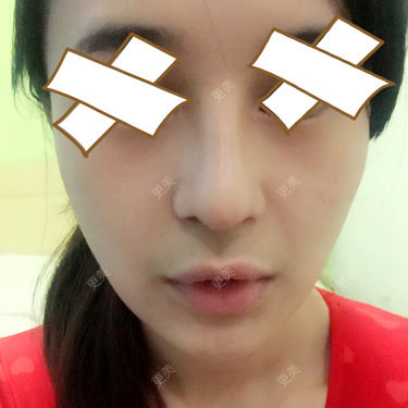 小小Rui