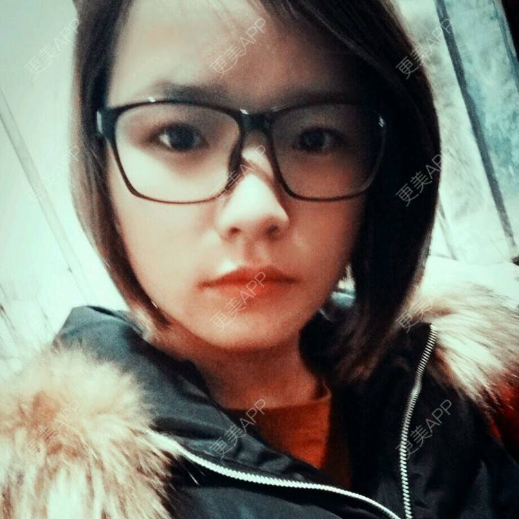 更美 - ヾ   疯疯癫癫小情绪的经验 | 远视矫正 | 绍兴