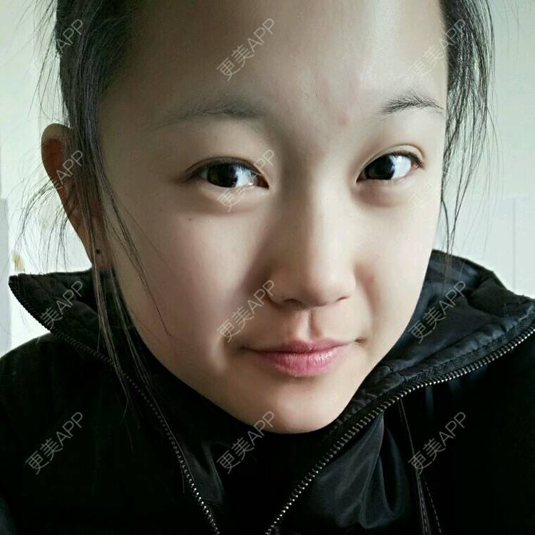 更美 - 美丽835536的经验 | 健康管理 | 滨州