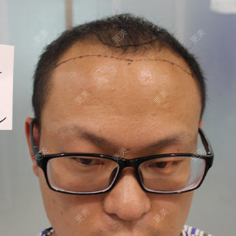 型知