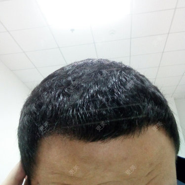 型知