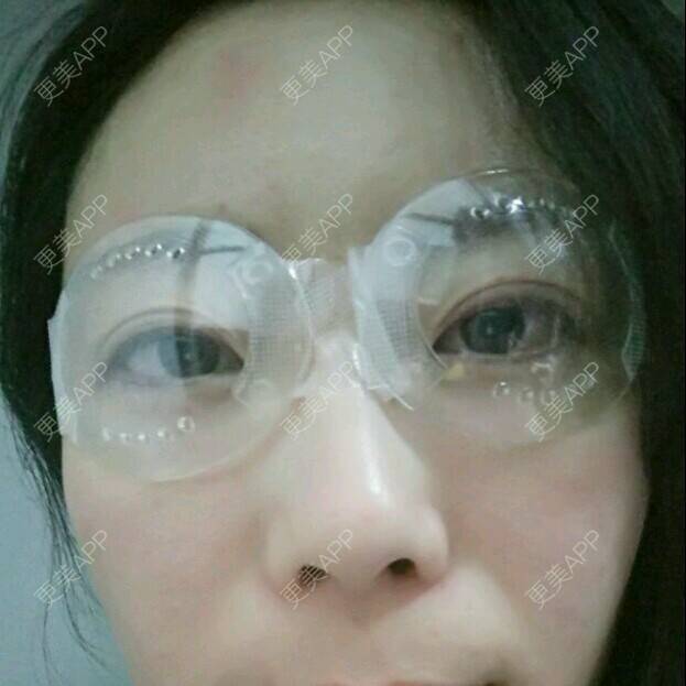 更美 - 清风起舞Winnie的准分子激光原位角膜磨镶术经验 | 准分子激光原位角膜磨镶术 | 美购日记 | 北京