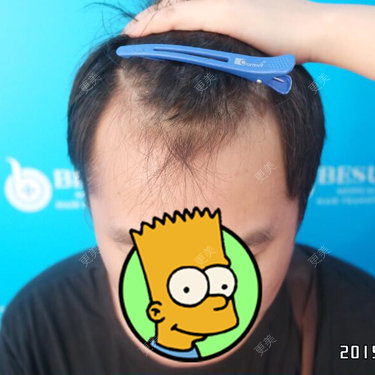 曾浩 医生