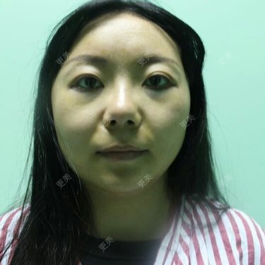 张作香 医生