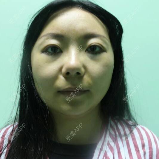 更美 - 张作香 医生的经验 | 成都