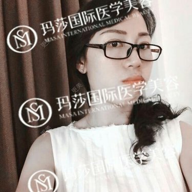 张作香 医生