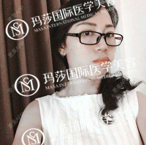 更美 - 张作香 医生的经验 | 成都