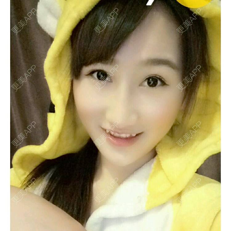 更美 - 98327的经验 | 补牙