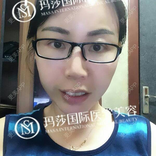 更美 - 张作香 医生的经验 | 成都