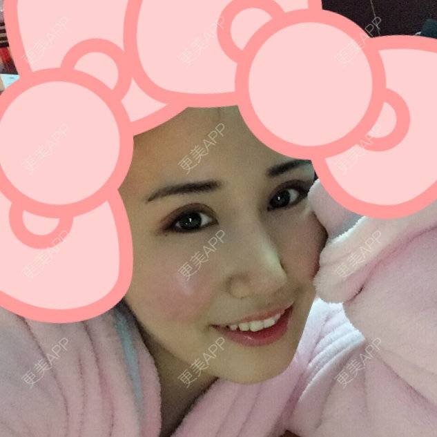 更美 - 美滴妞的全切双眼皮经验 | 眼部其他项目 | 全切双眼皮 | 开外眼角 | 美购日记 | 上眼睑去脂 | 眼皮下垂矫正 | 武汉