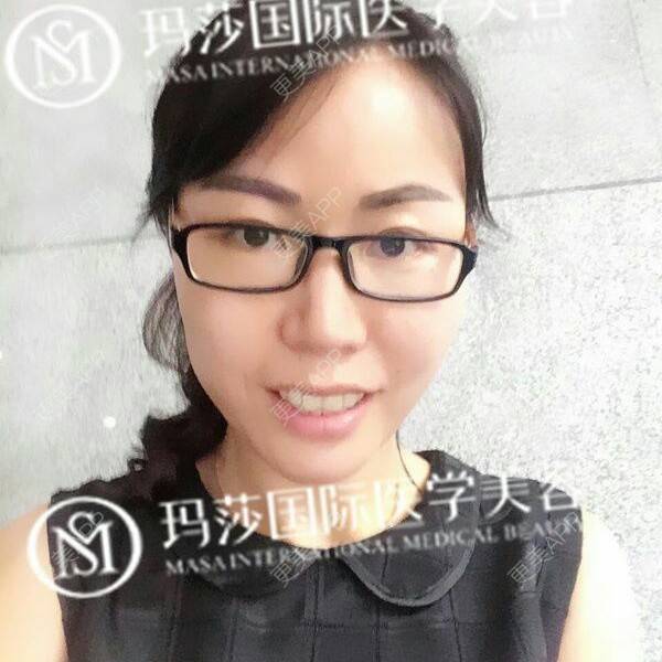 更美 - 张作香 医生的经验 | 成都