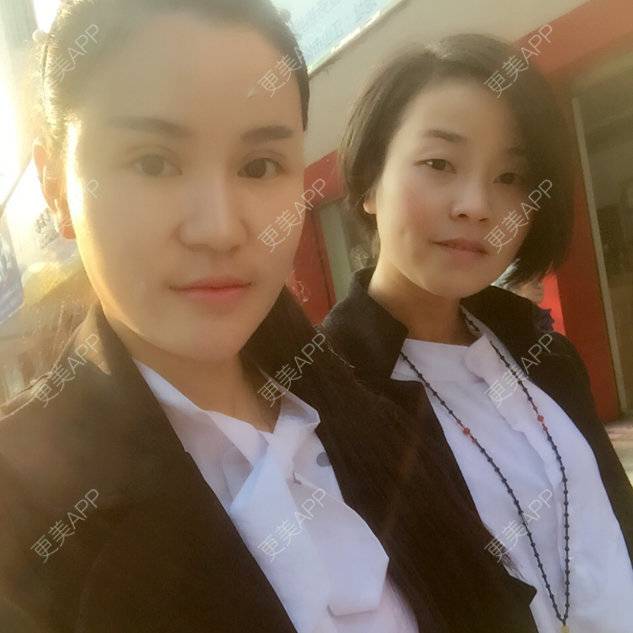 更美 - 뻔뻔한 거짓말的外切去眼袋经验 | 自体脂肪丰太阳穴 | 杭州 | 自体脂肪填充泪沟 | 自体脂肪垫下巴 | 外切去眼袋