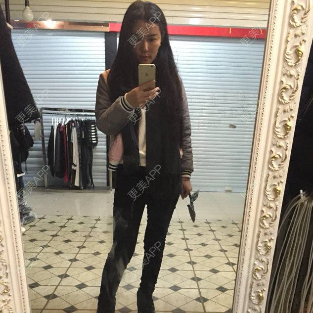 更美 - 뻔뻔한 거짓말的外切去眼袋经验 | 自体脂肪丰太阳穴 | 杭州 | 自体脂肪填充泪沟 | 自体脂肪垫下巴 | 外切去眼袋