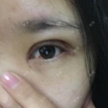 伊伊  💕