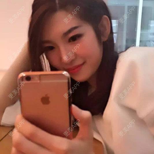 更美 - lady_becky的牙齿美白经验 | 注射美容 | 美购日记 | 美白牙齿 | 其他 | 北京