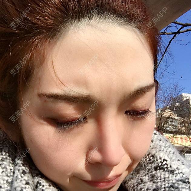更美 - lady_becky的牙齿美白经验 | 注射美容 | 美购日记 | 美白牙齿 | 其他 | 北京
