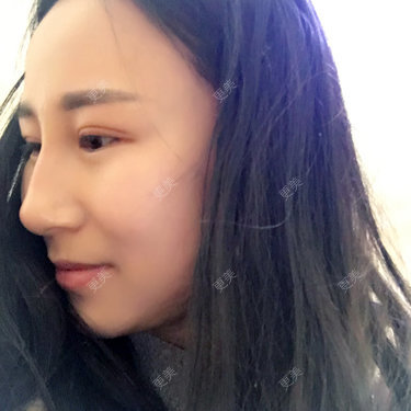 安妮🍒