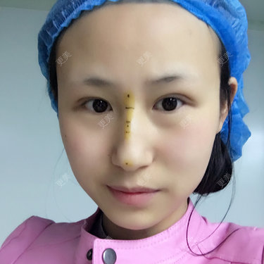 安妮🍒
