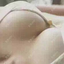 更美 - 哈尔滨索菲整形医院的经验