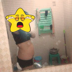 中医减肥其他项目