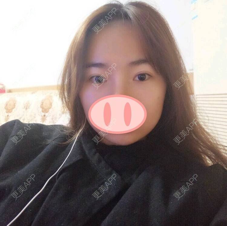 更美 - Rubby的经验 | 脱发际线 | 长沙