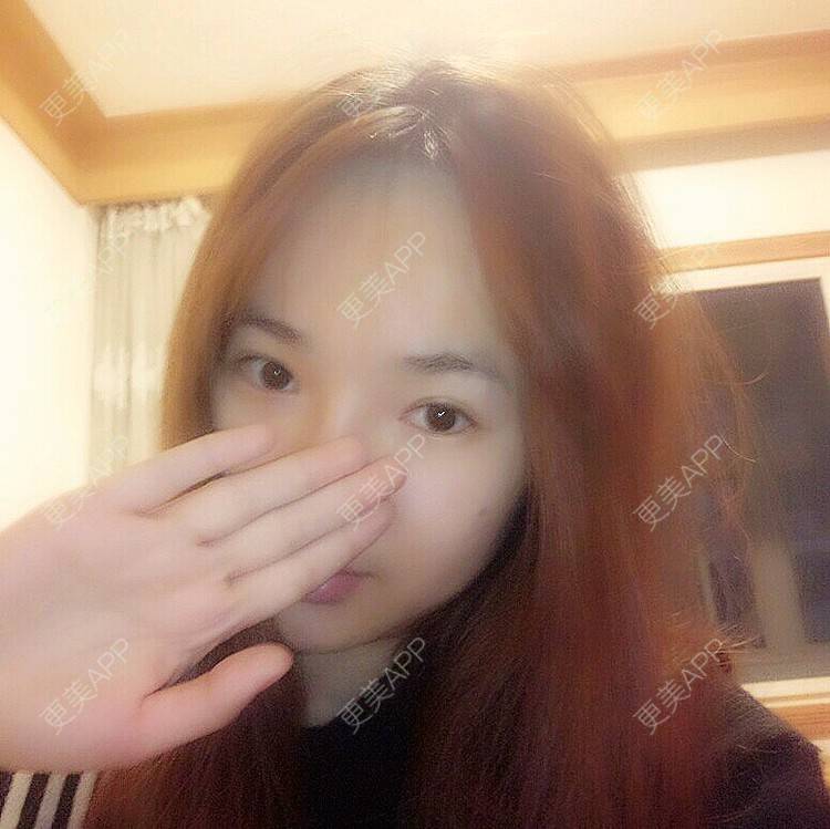 更美 - Rubby的经验 | 脱发际线 | 长沙