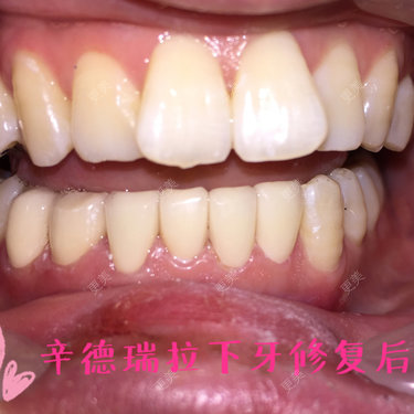 mo蕶薍﹎げ