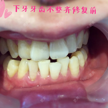 mo蕶薍﹎げ