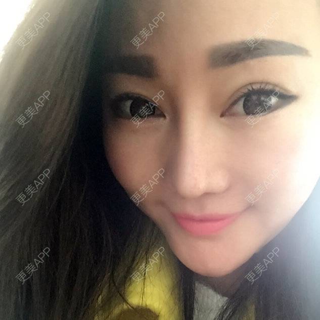更美 - 未来是教授的经验 | 鼻部多项 | 上饶