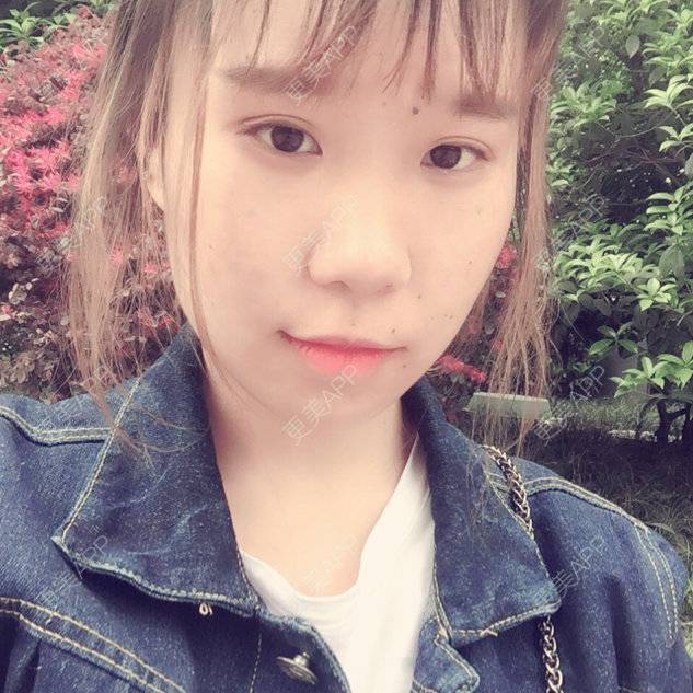 更美 - 更美用户78827998的经验 | 点阵激光 | 万州